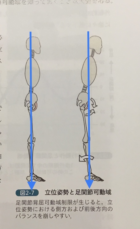 立つポジションが悪いと痛くなります