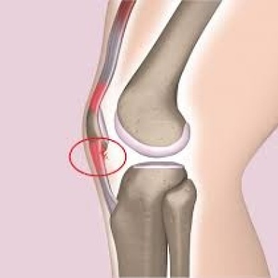 【トレラン下りの新常識】胸椎で衝撃を逃がし、膝をサスペンションに。180分Mクリニック