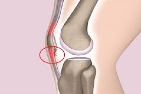 【トレラン下りの新常識】胸椎で衝撃を逃がし、膝をサスペンションに。180分Mクリニック